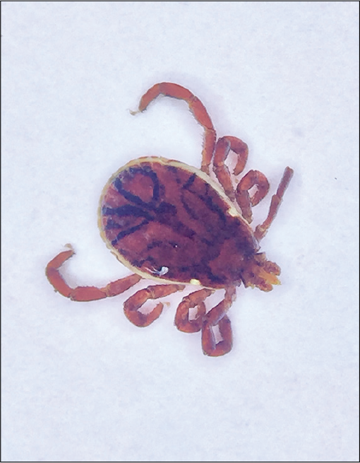 Dermoscopy (Dermlite DL4N, polarized mode, ×10) of the 8-legged Rhipicephalus sanguineus (commonly known as brown dog tick) with its intact hypostome.