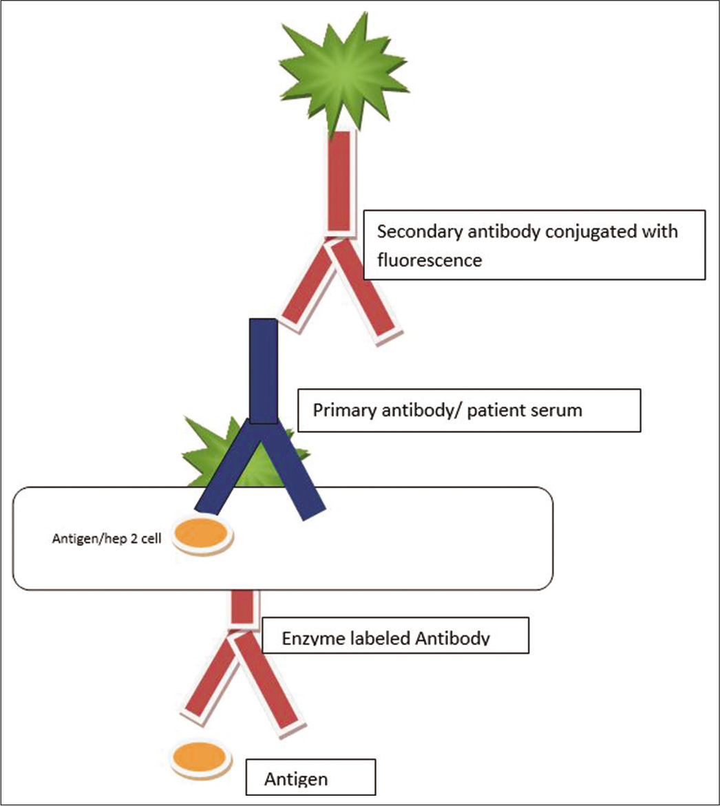 Anti Nuclear Antibodies A Practical Approach To Testing And