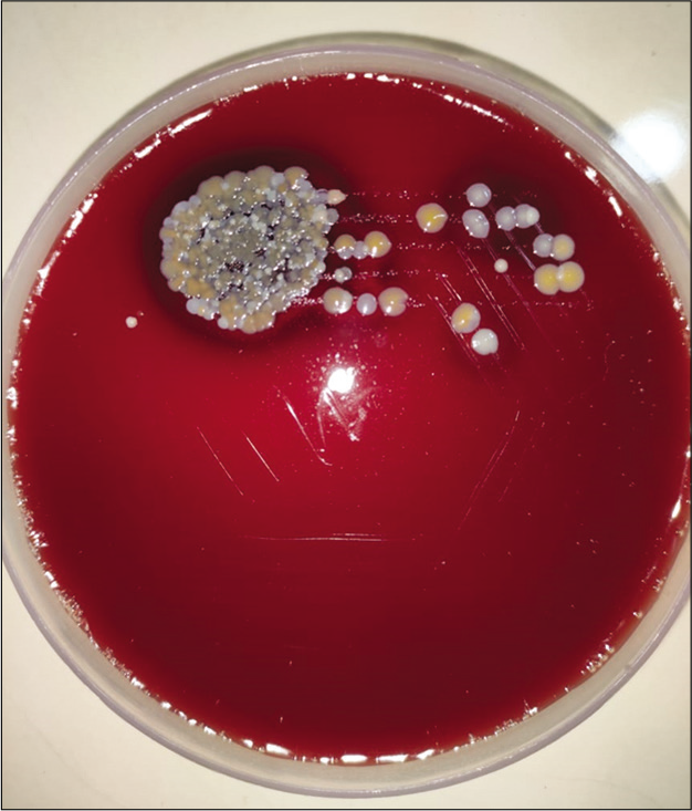 Blood agar showing colonies of gonococci.