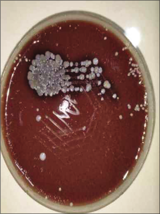 Chocolate agar showing colonies of gonococci.