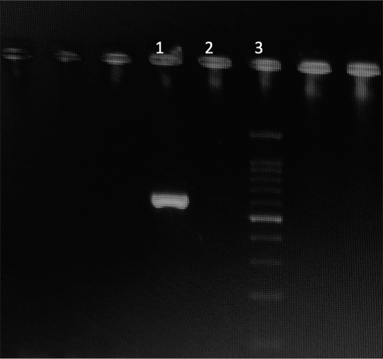 Gel picture showing amplicon of the Trichophyton mentagrophytes using Internal Transcribed Spacer (ITS) 1 and ITS 4 primers (Lane 1: Positive for T. mentagrophytes at 600 bp (approximately); Lane 2: Negative control; Lane 3:100bp DNA ladder).