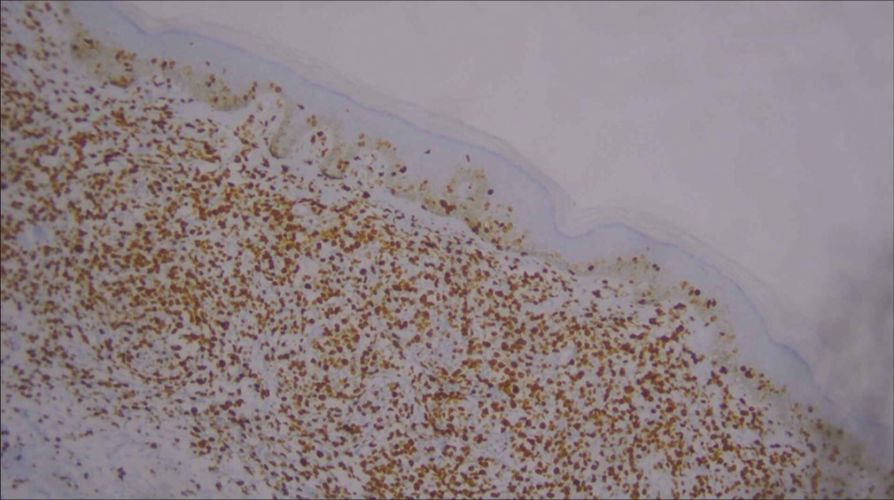 Low-power image of Ki-67 immunohistochemistry.